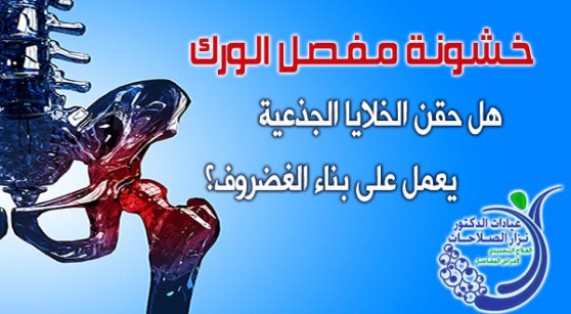 مفصل الورك